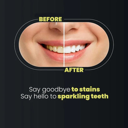 Teeth Whitening Blue Light Kit – Dental Care Device for Daily Oral Whitening Routine